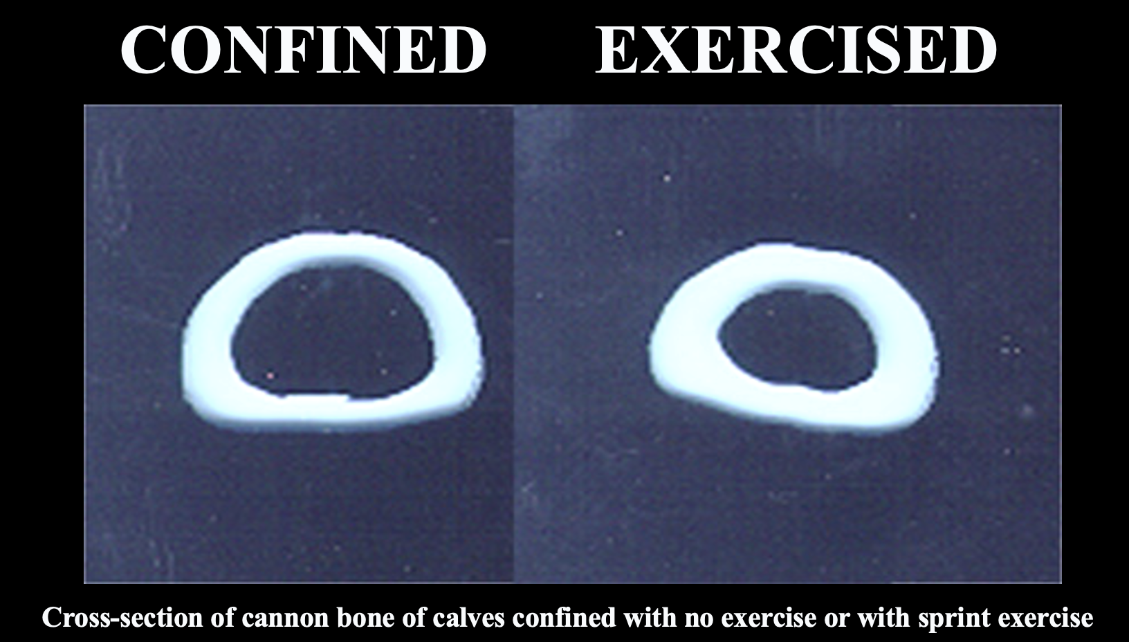 Bone Strength.png